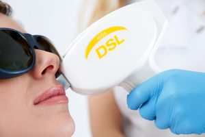 IPL Laser treatment hair removal ASPA Den Haag