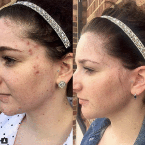 Screen Shot 2018 04 07 at 11.50.06