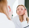How to reduce post-acne pigmentation and scarring