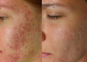 Screen Shot 2020 01 14 at 14.56.21