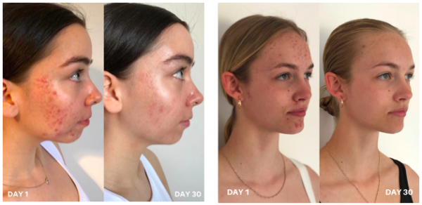 CLINISOOTHE+ SKIN PURIFIER 100ml - Image 3
