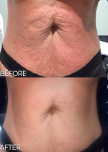 Screen Shot 2022 11 07 at 10.51.38