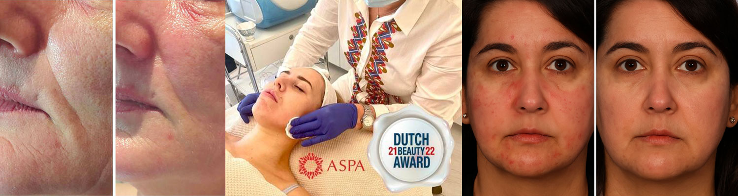 Peeling gezicht cover