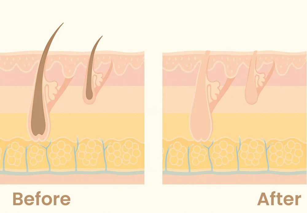 Important before the treatment