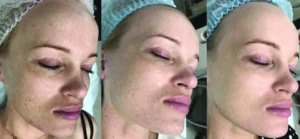 Why Choose Aspa Direct