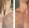 Do not forget your neck! Treatments, Nutrition & Strength Training